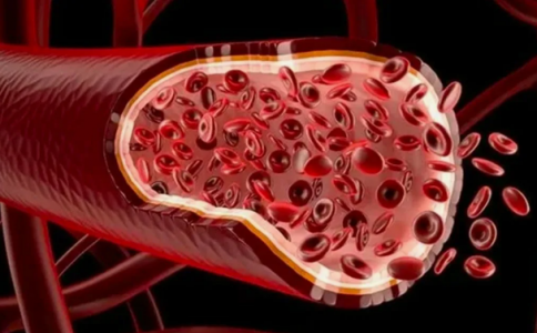 Сосуды станут шёлковые: атеросклероз больше не страшен — учёные нашли решение, испытания прошли успешно