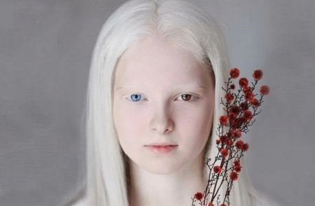 День в истории: 13 июня отмечается День альбиносов — вот над какими загадками «белых ворон» ученые до сих пор ломают голову