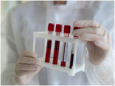 Доктор Мясников рассказал, за что на самом деле отвечает группа крови и как она влияет на нашу жизнь — научно доказанный факт