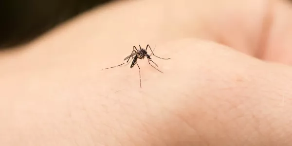 Зуд как рукой снимет: после укуса комара нанесите на поражённые участки это — станет легче через 10 минут