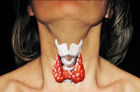Если совпали три признака: Как щитовидка заранее сигналит о проблемах — проверьте у себя эти симптомы и не доводите до удаления органа